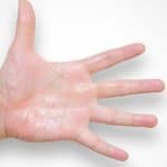 Penyebab Keringat Dingin